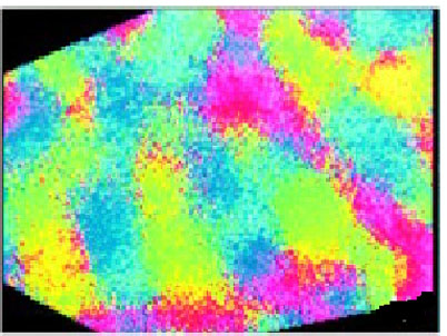 Orientation map driven by amplyopic eye